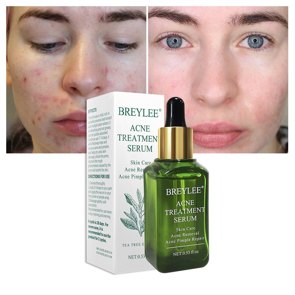Avelion - Targeted Acne Control Serum