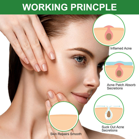Avelion ClearPatch – Invisible Colloidal Acne Cover