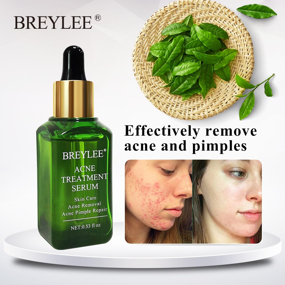 Avelion - Targeted Acne Control Serum
